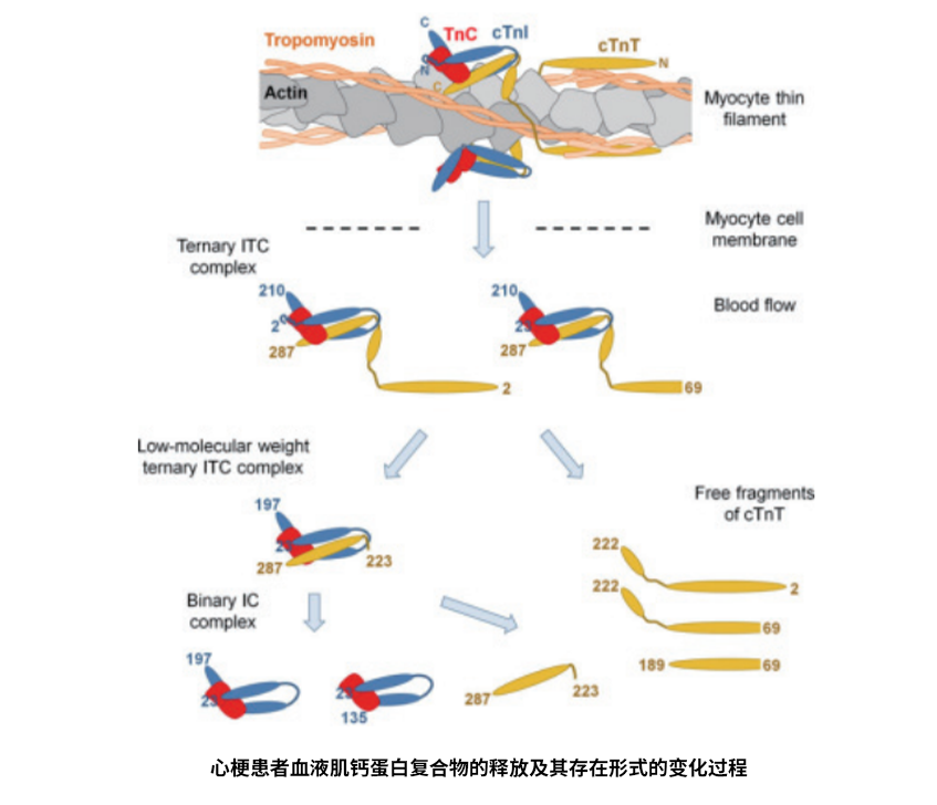 心梗患者血液肌钙蛋白复合物的释放及其存在形式