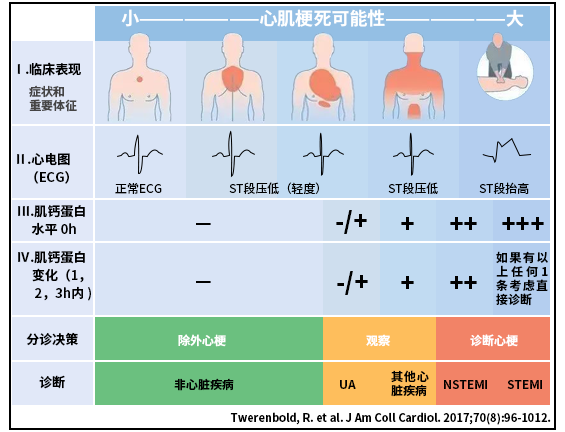 心肌梗死早期诊断图