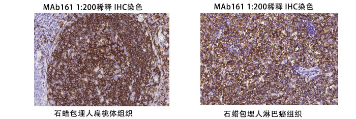 鼠抗人CD20抗体案例