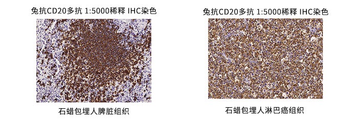 兔抗CD20多抗