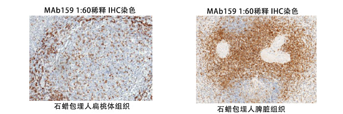 鼠抗人CD3抗体案例