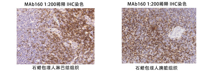 鼠抗人CD4抗体案例