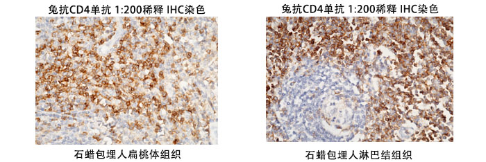 兔抗人CD4抗体案例