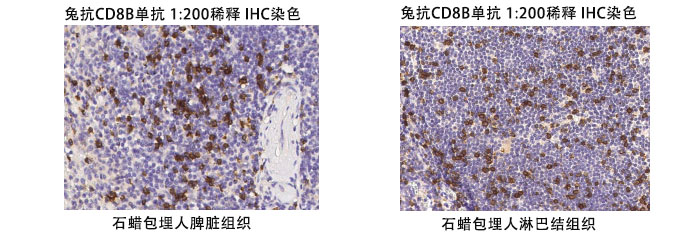 兔抗人CD8B抗体案例