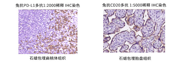 兔抗CD20多抗